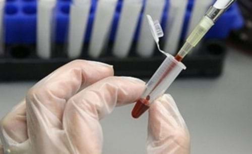 Xét nghiệm viêm gan B ở đâu ?Tại sao cần xét nghiệm viêm gan B?