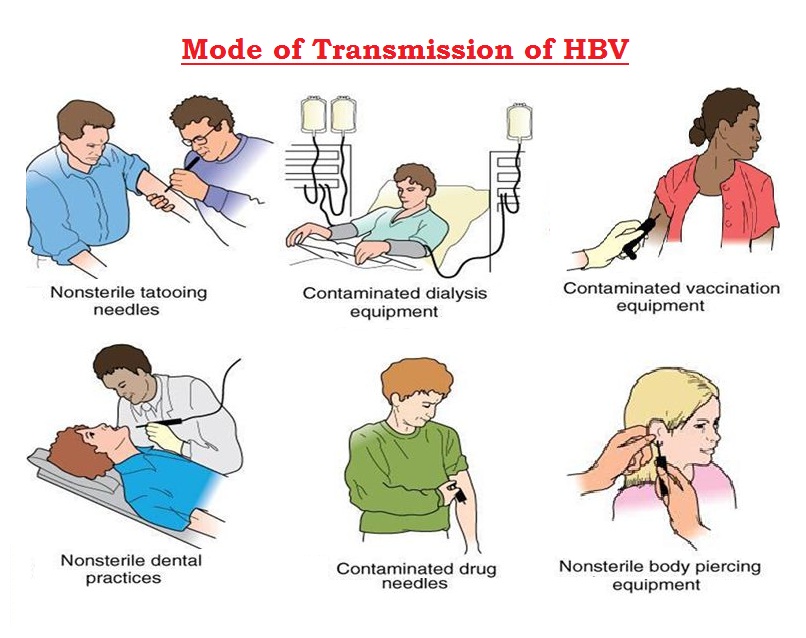 Các con đường lây truyền HBV phổ biến nhất
