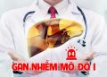 Gan nhiễm mỡ độ 1: Nguyên nhân, triệu chứng và cách điều trị
