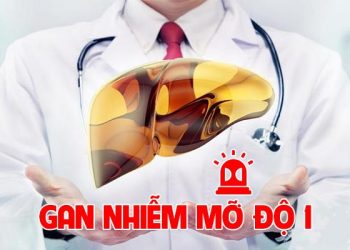 Gan nhiễm mỡ độ 1: Nguyên nhân, triệu chứng và cách điều trị