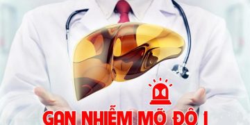 Gan nhiễm mỡ độ 1: Nguyên nhân, triệu chứng và cách điều trị