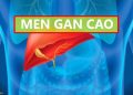 Men gan cao – Nguyên nhân, biểu hiện, biến chứng và cách điều trị