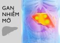 Gan nhiễm mỡ – Nguyên nhân, biểu hiện, triệu chứng và cách điều trị