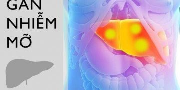 Gan nhiễm mỡ – Nguyên nhân, biểu hiện, triệu chứng và cách điều trị
