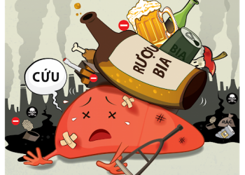Rượu, bia thường xuyên, gan nhiễm mỡ không kiêng khem thì sống được bao lâu? Mách bạn cách này