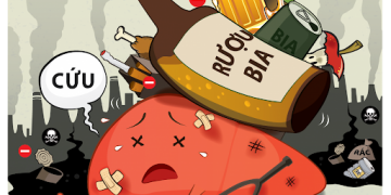 Rượu, bia thường xuyên, gan nhiễm mỡ không kiêng khem thì sống được bao lâu? Mách bạn cách này